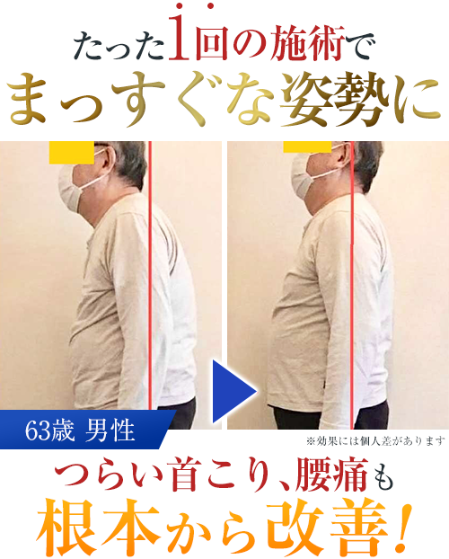 ビフォーアフター