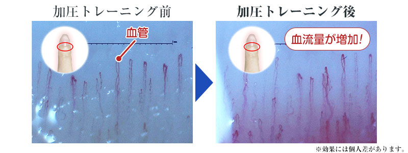加圧トレーニング